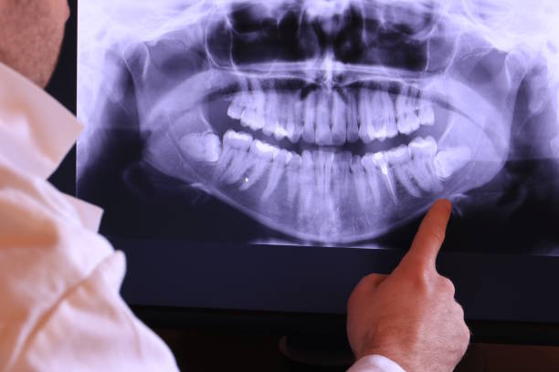 Best Weekend Emergency Dentist in Eslon, CA