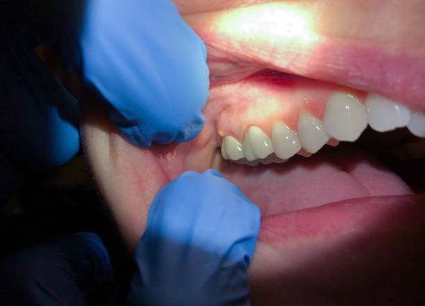 Best Pediatric Emergency Dentist in Eslon, CA