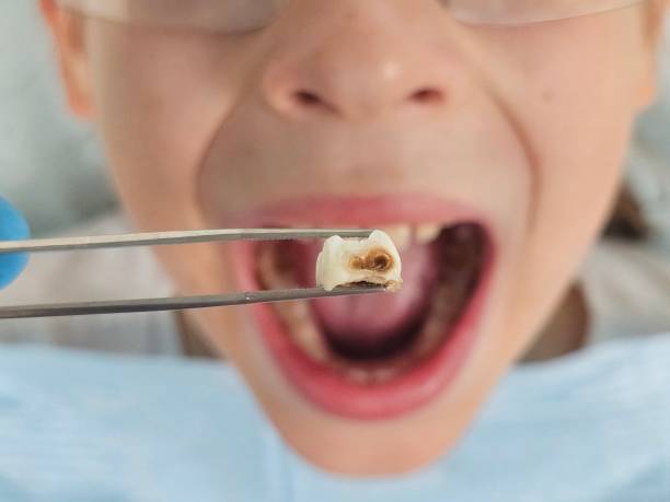 Best Mobile Emergency Dentist in Eslon, CA